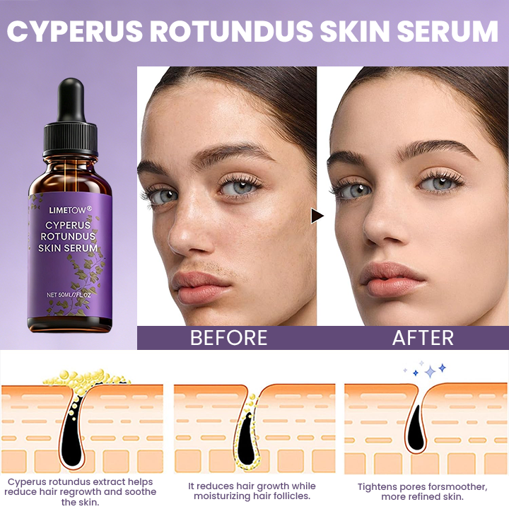 LIMETOW® Cyperus Rotundus Skin Serum
