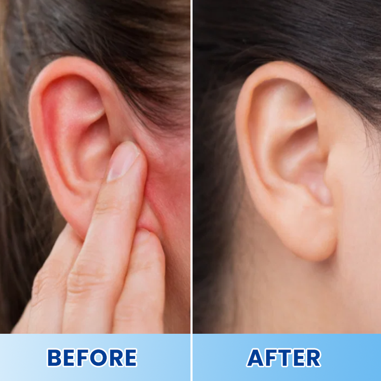 LIMETOW® Tinnitus Patch