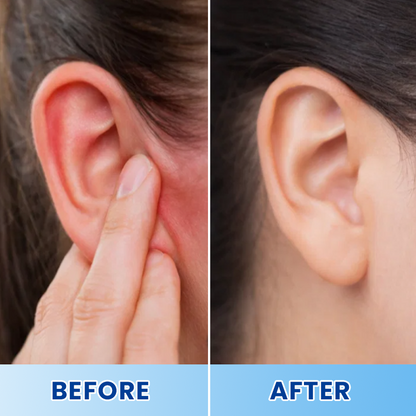 LIMETOW® Tinnitus Patch