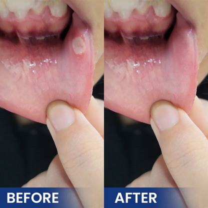 LIMETOW® Bee Venom Oral Care Solution