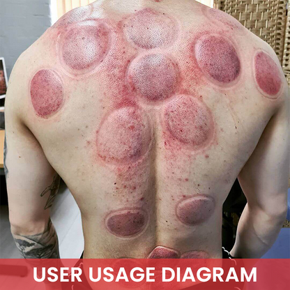 LIMETOW® Vacuum Cupping and Scraping Instrument