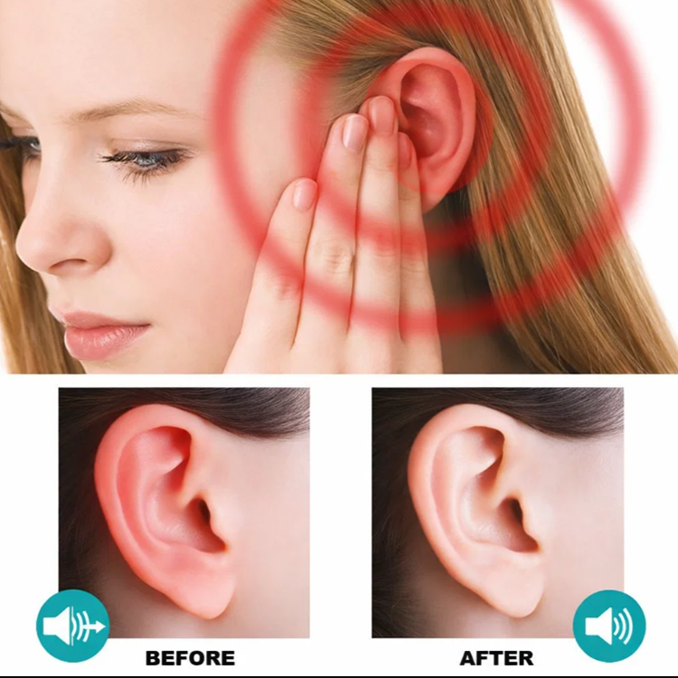 LIMETOW® Tinnitus Patch