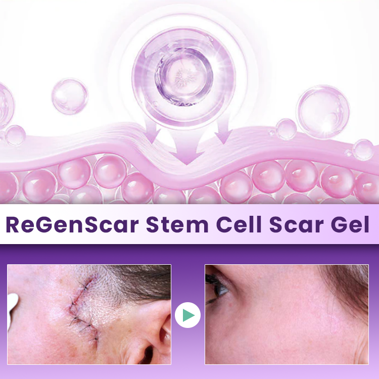 LIMETOW® ReGenScar Stem Cell Scar Gel