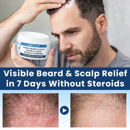 LIMETOW® Visible Beard & Scalp Relief in 7 Days Without Steroids