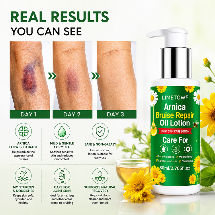 LIMETOW® Arnica Bruise Repair Oil Lotion