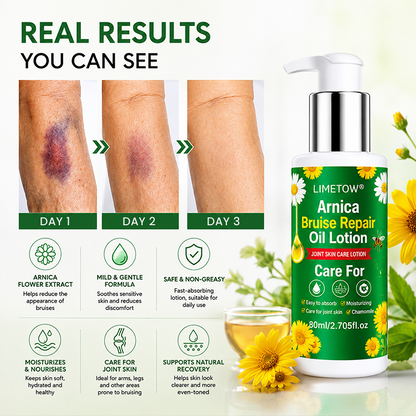 LIMETOW® Arnica Bruise Repair Oil Lotion