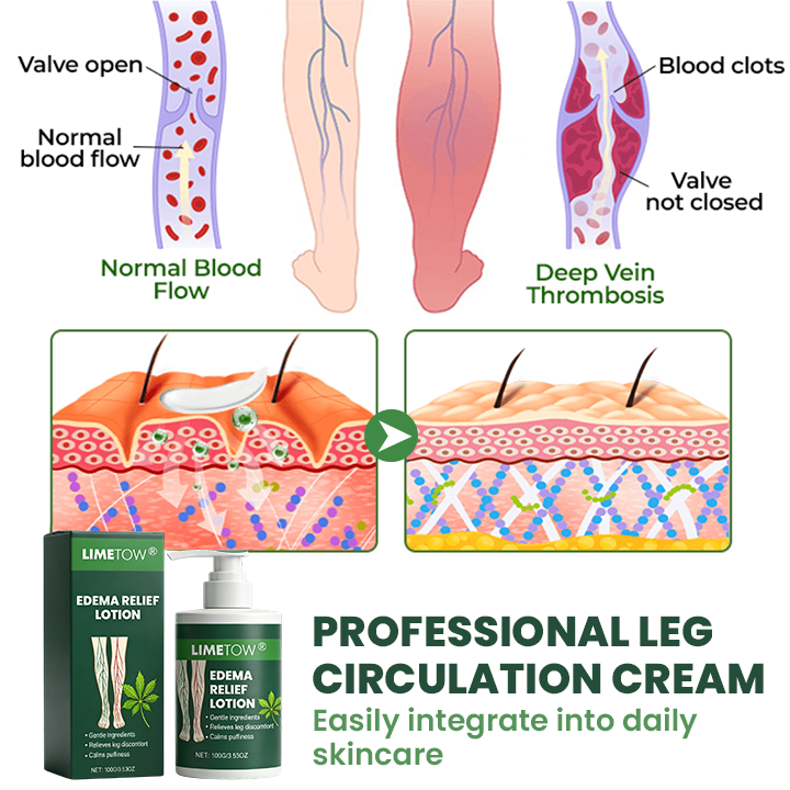 LIMETOW® Edema Relief Lotion