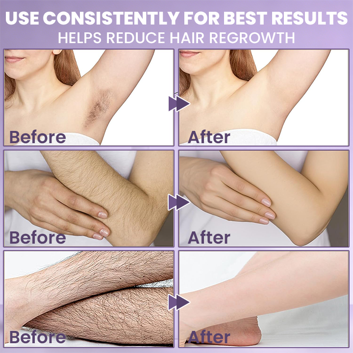 LIMETOW® Cyperus Rotundus Skin Serum