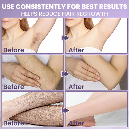 LIMETOW® Cyperus Rotundus Skin Serum