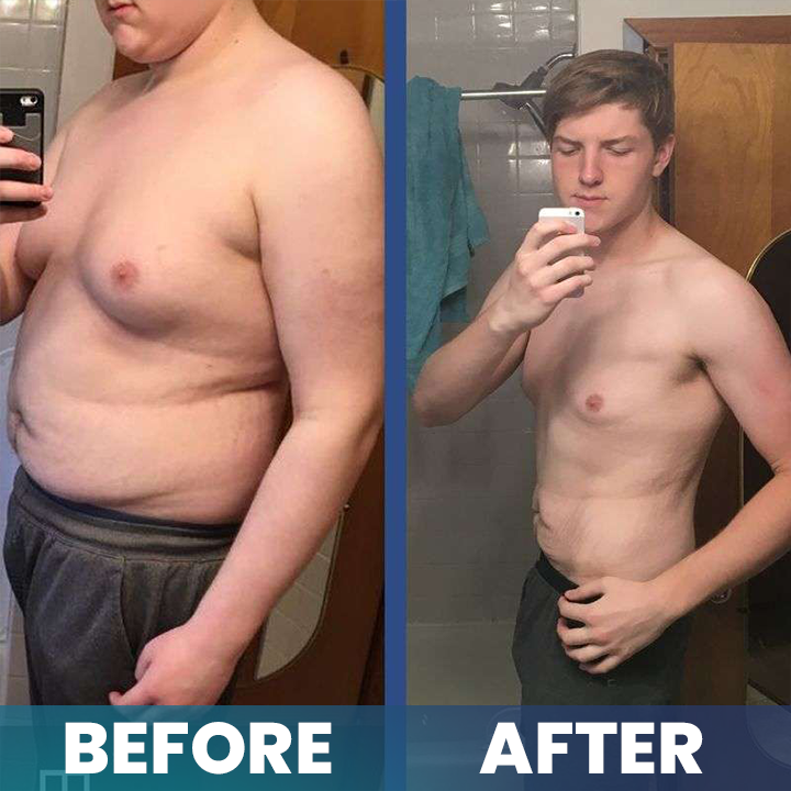 LIMETOW® Nanomedix Gynecomastia Chest Fat Burning & Firming Patch