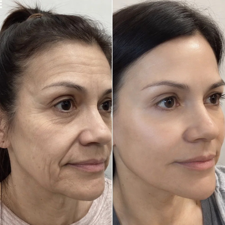 LIMETOW® Collagen Firming Cream💖LAST DAY SALE - 80% OFF