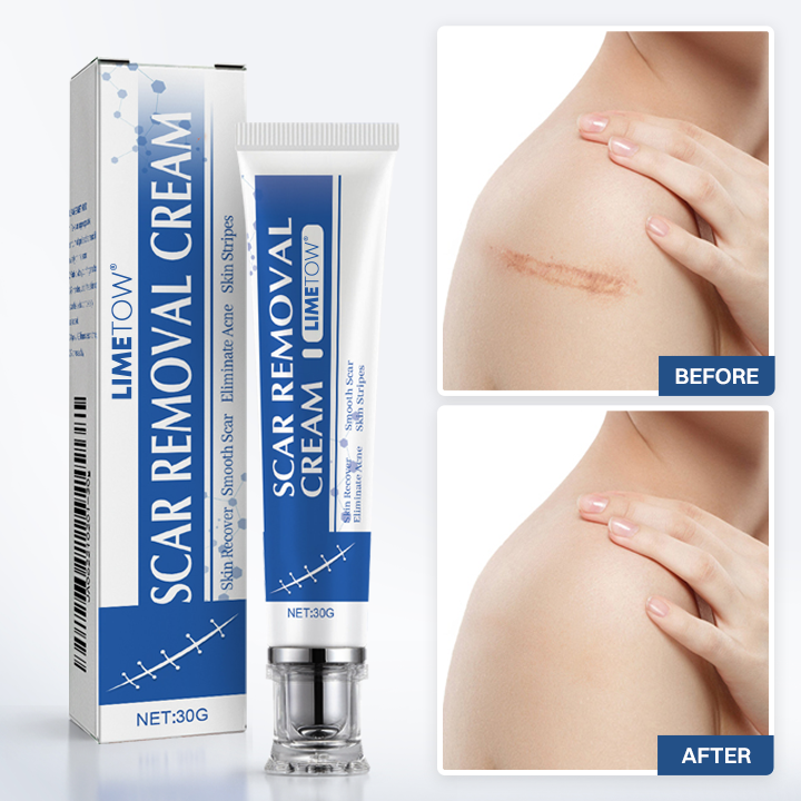 LIMETOW® Scar Removal Cream
