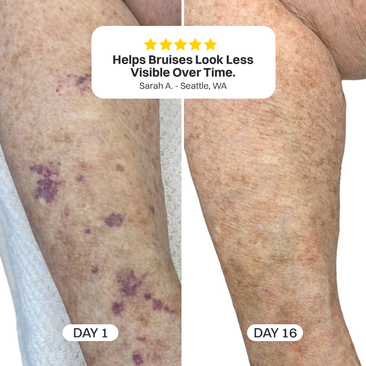 💥200K+ SOLD💕- LIMETOW® Bruise Repair & Skin-Strengthening Cream