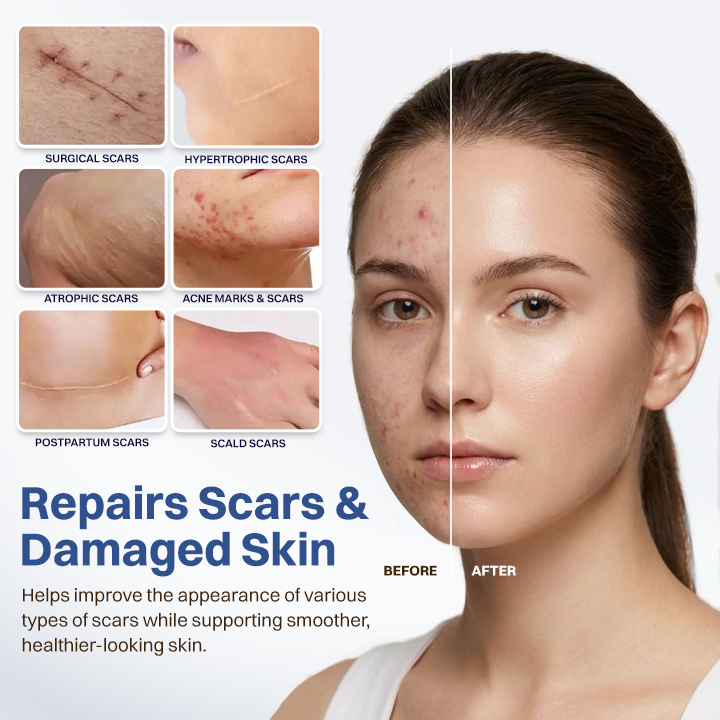 LIMETOW® Scar Removal Cream