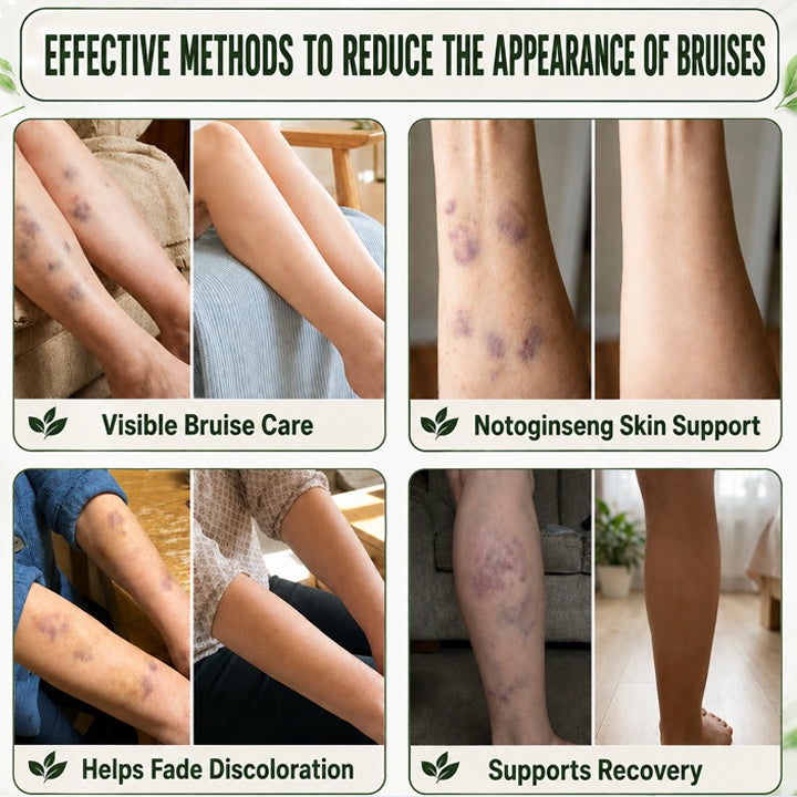 LIMETOW® Skin Strengthening Cream– Natural Relief for Bumps, Impacts & Everyday Scrapes
