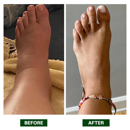 LIMETOW® Arnica Bruise Repair Oil Lotion