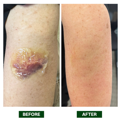 LIMETOW® Arnica Bruise Repair Oil Lotion