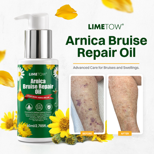 LIMETOW® Arnica Bruise Repair Oil Lotion