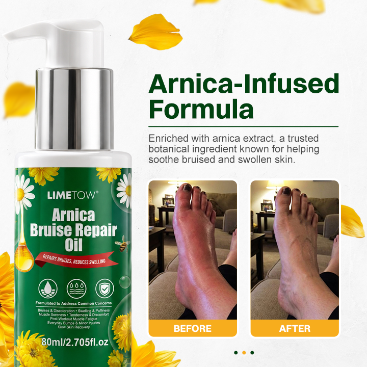 LIMETOW® Arnica Bruise Repair Oil Lotion
