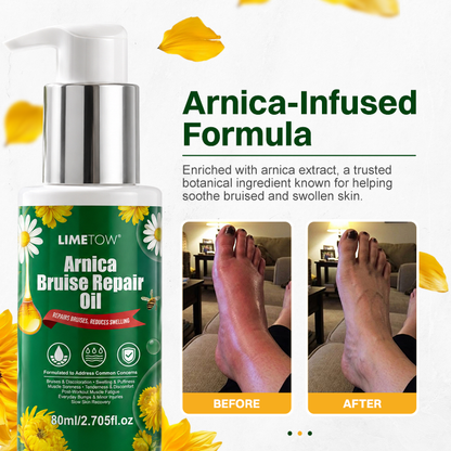 LIMETOW® Arnica Bruise Repair Oil Lotion