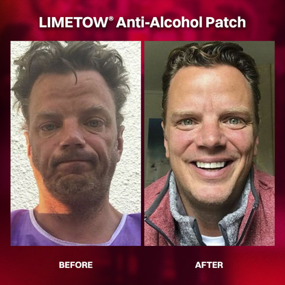 LIMETOW® Anti-Alcohol Patch