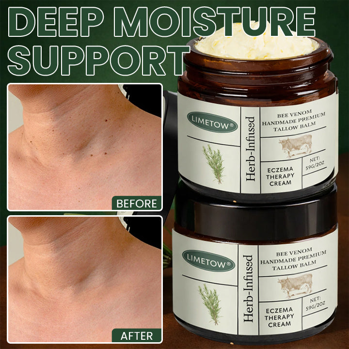 LIMETOW® Bee Venom Handmade Premium Tallow Balm – Herb-Infused Eczema Therapy Cream
