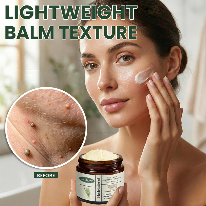 LIMETOW® Bee Venom Handmade Premium Tallow Balm – Herb-Infused Eczema Therapy Cream