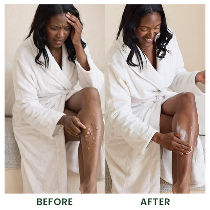 LIMETOW® Bee Venom Handmade Premium Tallow Balm – Herb-Infused Eczema Therapy Cream