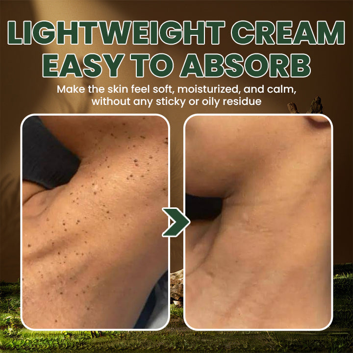 LIMETOW® Bee Venom Handmade Premium Tallow Balm – Herb-Infused Eczema Therapy Cream